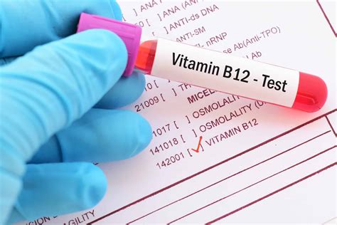 vitamin b12 blood test bottle|b12 deficiency nhs guidelines.